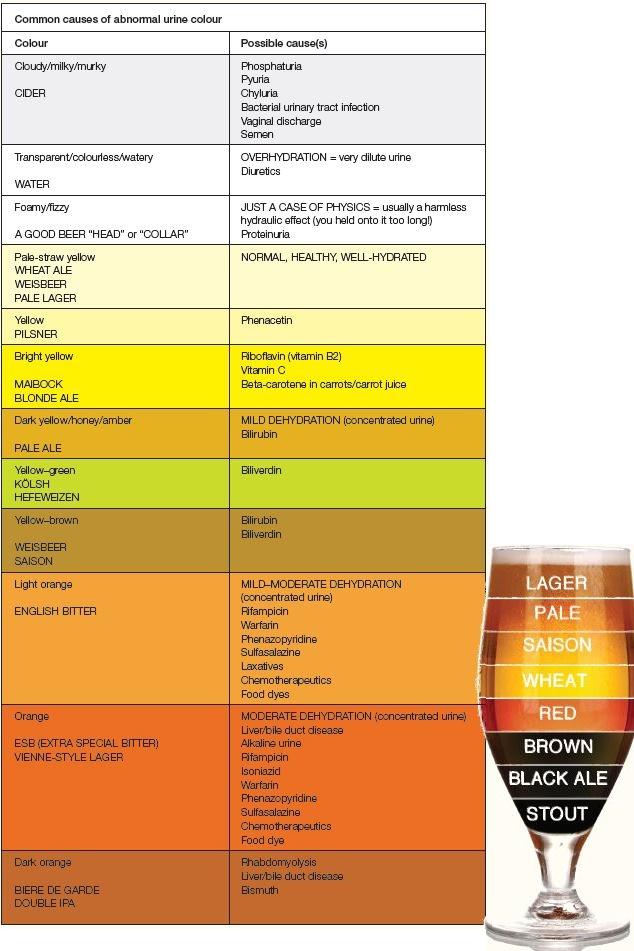 Urine chart