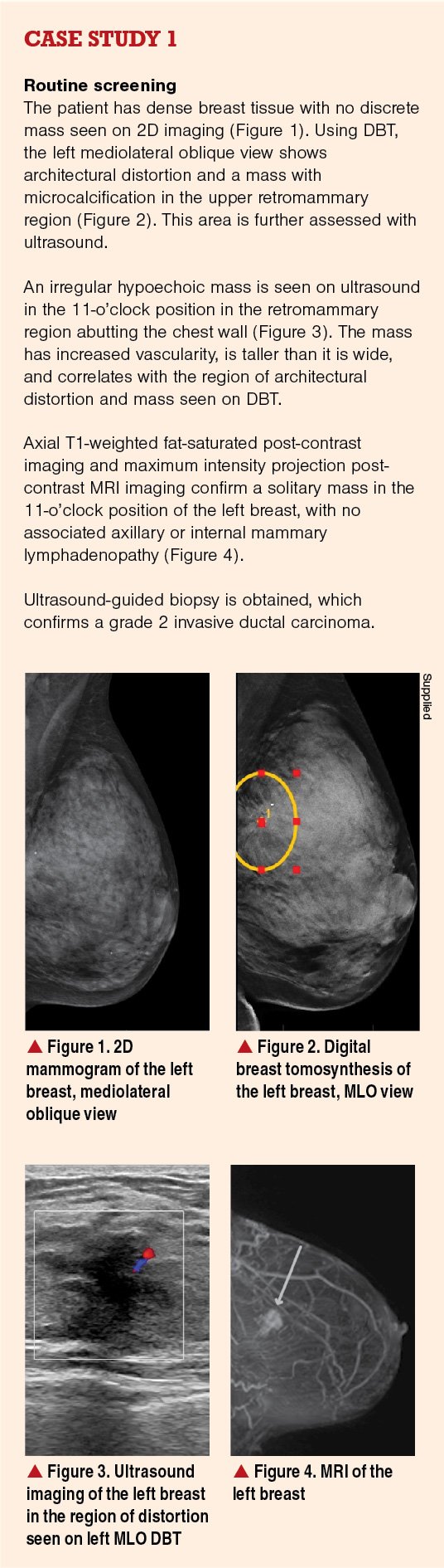 Case study 1 on routine screening