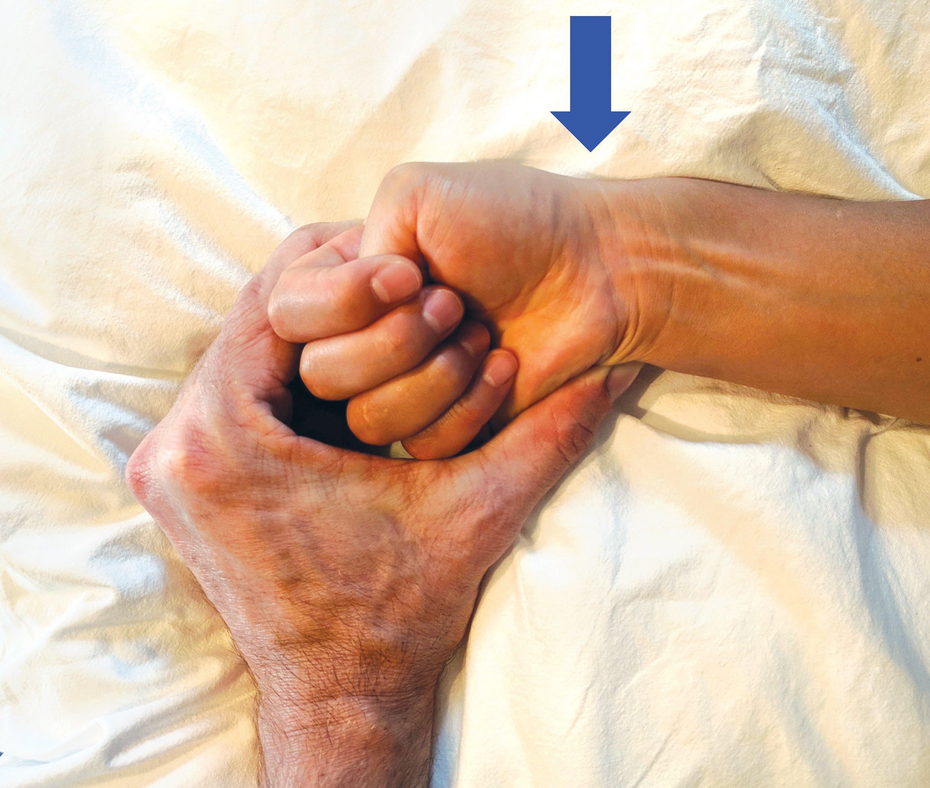 Wrist store sprain exercises
