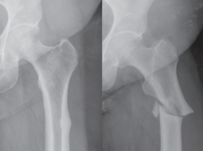 X Rays