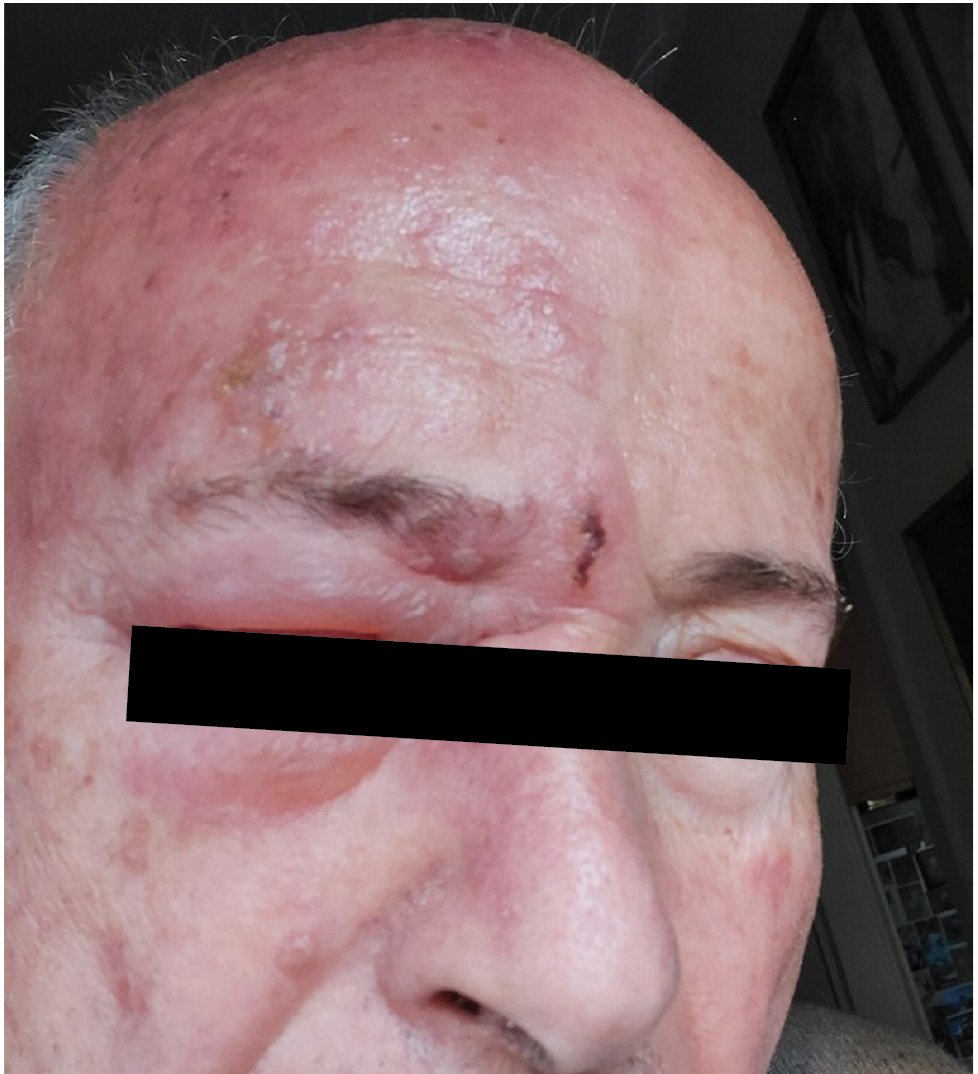 Figure_2_Clinical_Update
